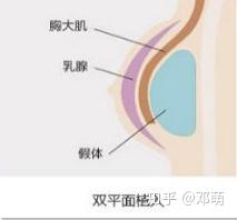 什么方法可以安全有效丰胸？