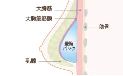 资深整容的经验之谈—丰胸